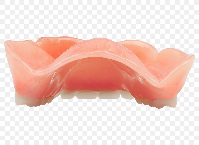 Dentures Jaw, PNG, 800x599px, Dentures, Jaw, Lip, Peach Download Free