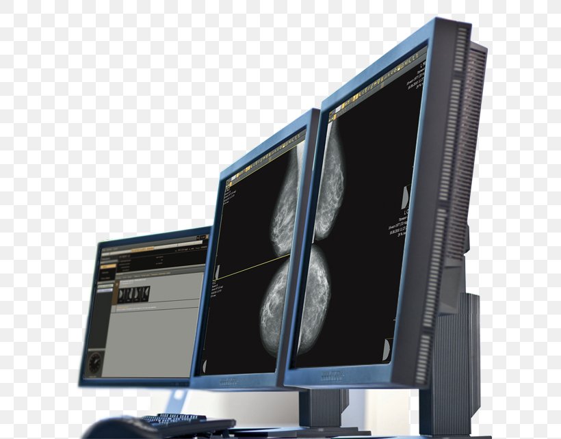 Computer Monitors Computer Hardware Doctor Of Medicine Health Technology, PNG, 640x642px, Computer Monitors, Computer, Computer Hardware, Computer Monitor, Computer Monitor Accessory Download Free