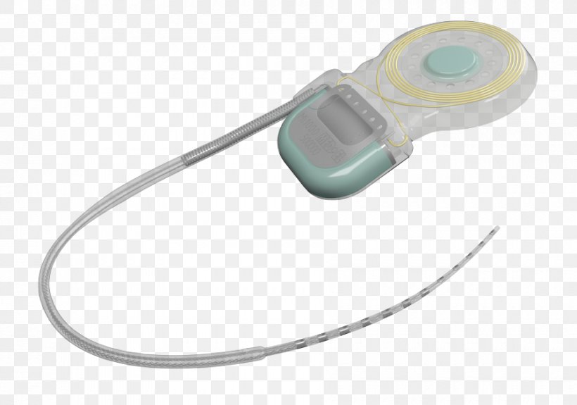 MED-EL Cochlear Implant Europe Safety, PNG, 900x632px, Medel, Cable, Choice, Cochlea, Cochlear Implant Download Free