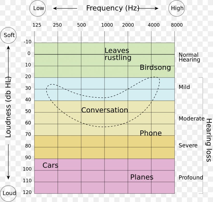 Hearing Loss Hearing Range Hearing Test Audiogram, PNG, 1078x1024px, Hearing, Area, Audio Frequency, Audiogram, Audiology Download Free