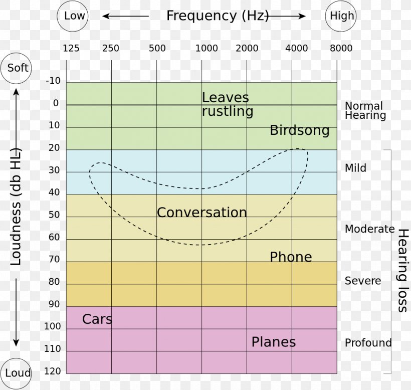 Hearing Loss Hearing Range Hearing Test Audiogram, PNG, 1078x1024px ...