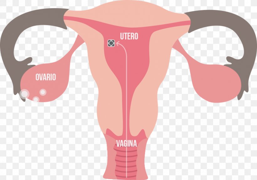 Ovary Female Reproductive System Endometrium Uterus, PNG, 847x594px, Ovary, Drinkware, Endocrine System, Endometriosis, Endometrium Download Free