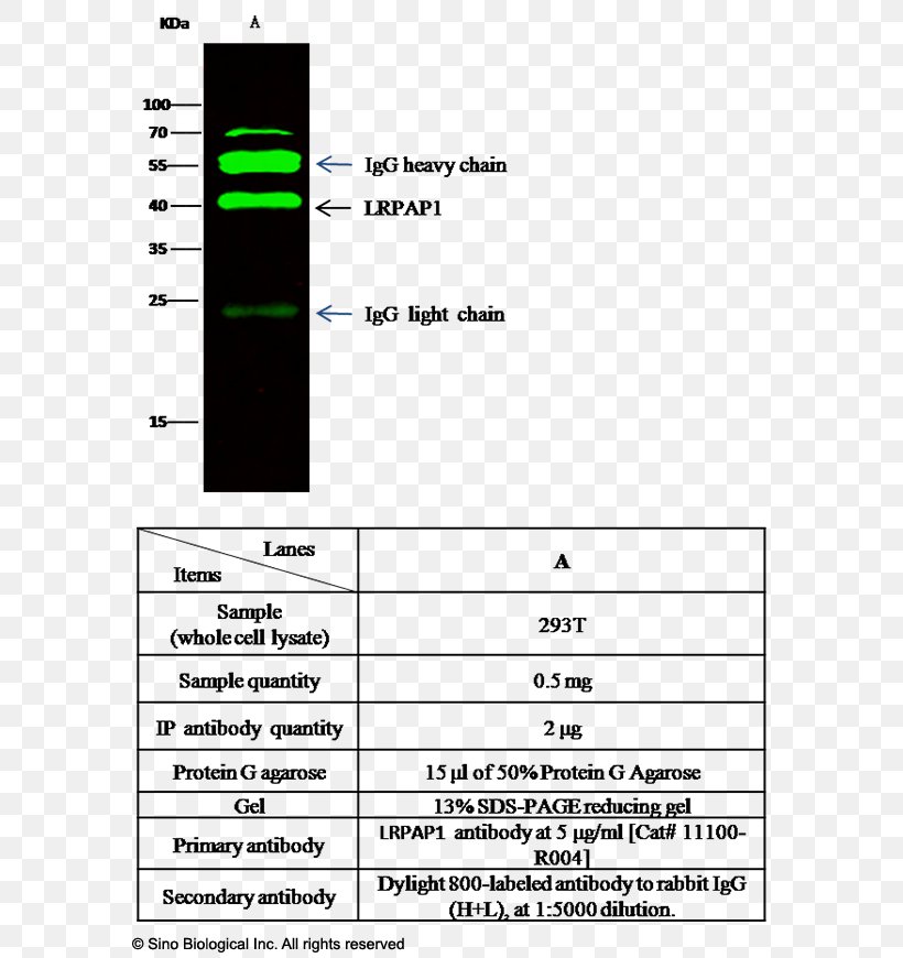 Document Line Angle, PNG, 598x870px, Document, Area, Diagram, Paper, Parallel Download Free