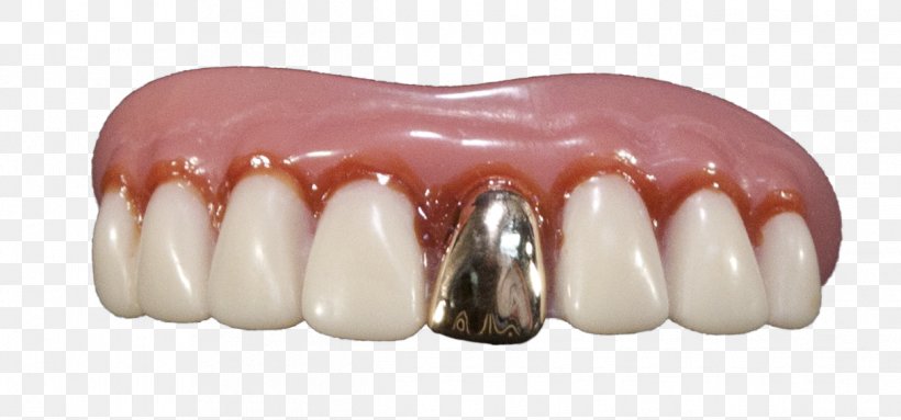 Dentures Human Tooth Gold Teeth, PNG, 1215x568px, Dentures, Crown, Deciduous Teeth, Dental Braces, Fang Download Free