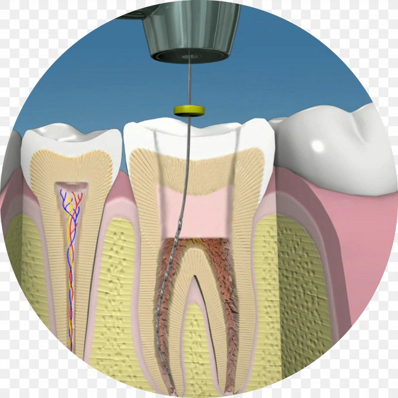 Endodontic Therapy Dentistry Human Tooth Pulp, PNG, 3607x3607px, Watercolor, Cartoon, Flower, Frame, Heart Download Free