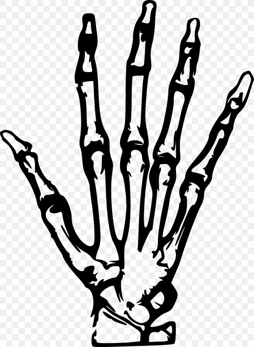 X-ray Hand Clip Art, PNG, 936x1280px, Xray, Arm, Black And White, Branch, Finger Download Free