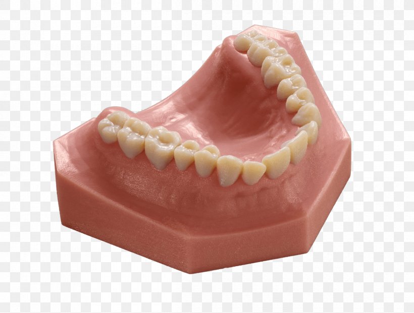 Dentistry Stratasys 3D Printing Orthodontics Printer, PNG, 1200x909px, 3d Printers, 3d Printing, Dentistry, Dental Laboratory, Dentures Download Free