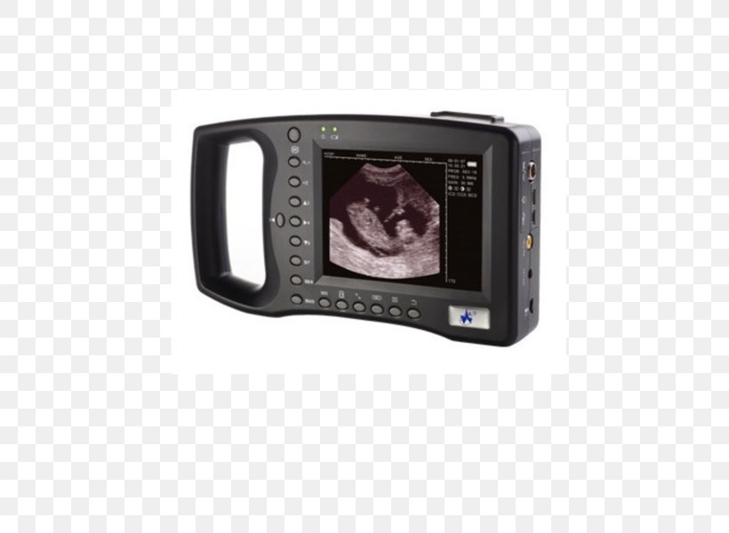 Ultrasound Ultrasonography Medicine Medical Diagnosis Doppler Echocardiography, PNG, 586x600px, 3d Ultrasound, Ultrasound, Camera, Cameras Optics, Digital Camera Download Free