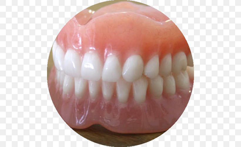 Dentures Prosthesis Dentistry Dental Implant Tooth, PNG, 500x500px, Dentures, Crown, Dental Extraction, Dental Implant, Dentistry Download Free