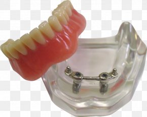 Skull - Tooth Mandible Dentures Jaw Anatomy PNG