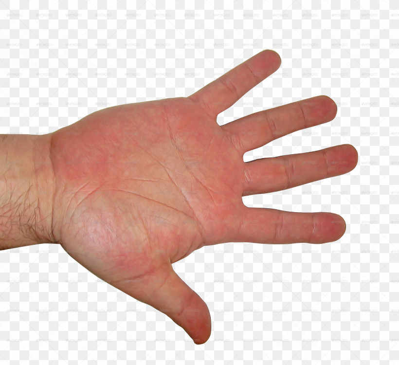 Finger Hand Skin Thumb Nail, PNG, 2672x2444px, Finger, Arm, Gesture, Hand, Joint Download Free