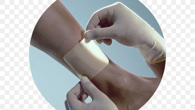 Dressing Wound Tratamento Therapy Nursing, PNG, 581x464px, Dressing, Arm, Bandage, Caregiver, Cast Download Free