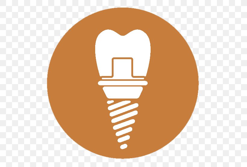 Dentistry Dental Implant My Dentist In Plano: Darren Dickson, DDS Geology, PNG, 556x556px, Dentist, Acid Erosion, Corrosion, Dental Implant, Dentistry Download Free