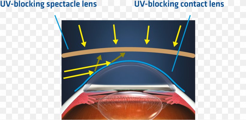 Johnson & Johnson Contact Lenses Ultraviolet Glasses, PNG, 1153x565px, Johnson Johnson, Acuvue, Brand, Contact Lenses, Eye Download Free