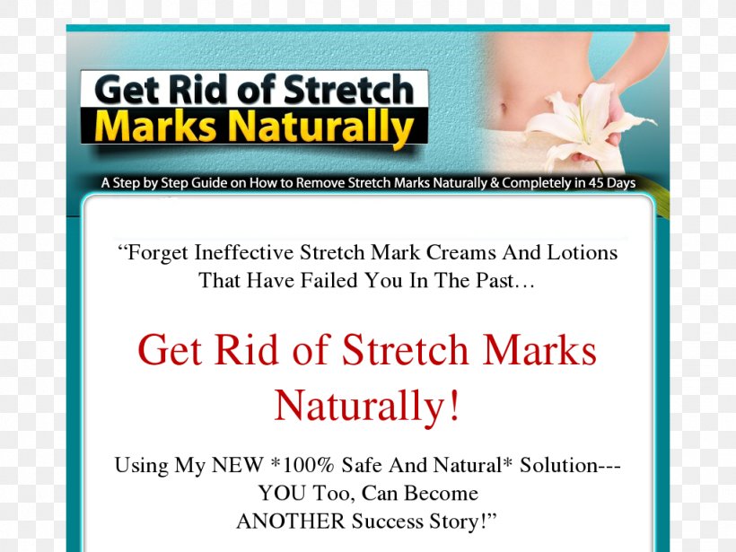 Stretch Marks Web Page, PNG, 1024x768px, Stretch Marks, Advertising, Banner, Brand, Document Download Free