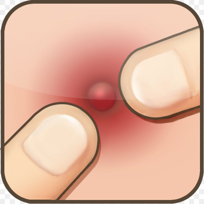 Pimple Acne Kindle Fire App Store Flappy Bird, PNG, 1024x1024px, Pimple, Acne, App Store, Finger, Flappy Bird Download Free