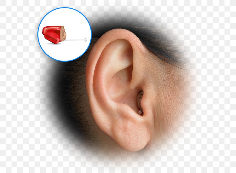 Hearing Aid Hearing Test Audiology, PNG, 600x600px, Hearing Aid, Amplifon, Audiology, Chin, Close Up Download Free