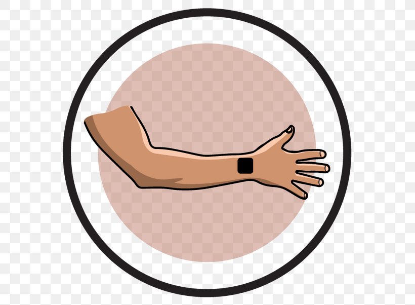 Transcutaneous Electrical Nerve Stimulation Thumb Elbow Electrical Muscle Stimulation Hand, PNG, 600x602px, Thumb, Arm, Back Pain, Elbow, Electrical Muscle Stimulation Download Free
