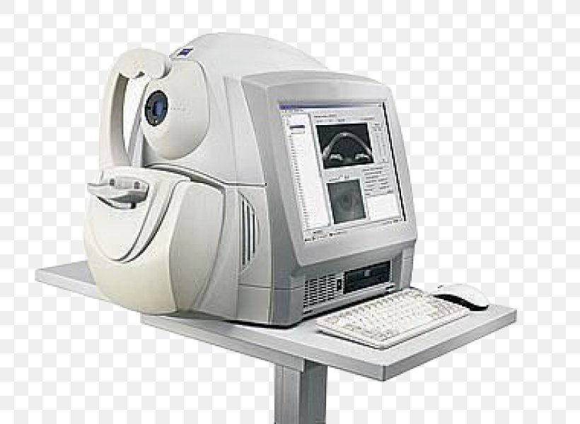 Optical Coherence Tomography Ophthalmology Optics, PNG, 755x600px, Optical Coherence Tomography, Bildgebendes Verfahren, Coherence, Eye, Glaucoma Download Free