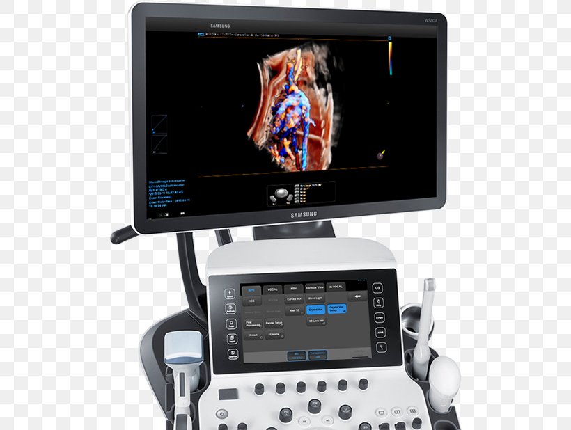 Ultrasonography Ultrasound Obstetrics And Gynaecology Radiology Medical Diagnosis, PNG, 610x618px, Ultrasonography, Display Device, Electronics, Family Medicine, Gynaecology Download Free