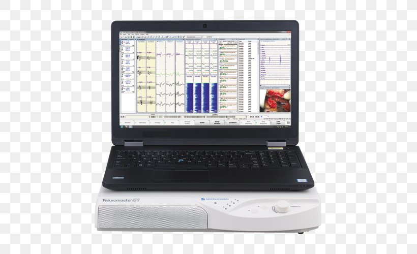 Netbook Laptop Computer Hardware Personal Computer Computer Monitors, PNG, 530x500px, Netbook, Cardiology, Computer, Computer Hardware, Computer Monitors Download Free