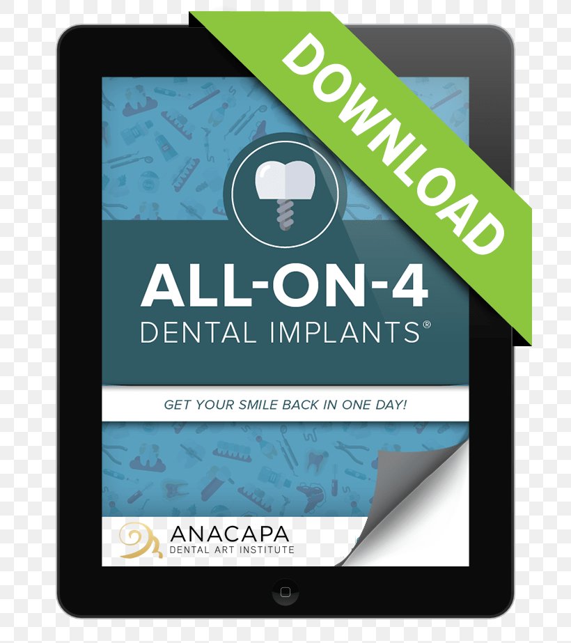 All-on-4 Dental Implant Dentist Tooth Bellevue Dental Care & Implant Center, PNG, 712x923px, Dental Implant, Blue, Brand, Dentist, Dentistry Download Free