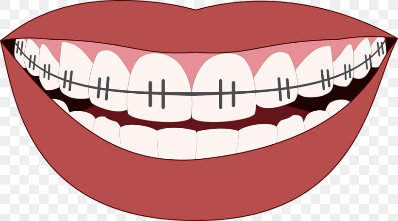 Cosmetic Dentistry Orthodontics Dental Implant, PNG, 960x533px, Watercolor, Cartoon, Flower, Frame, Heart Download Free