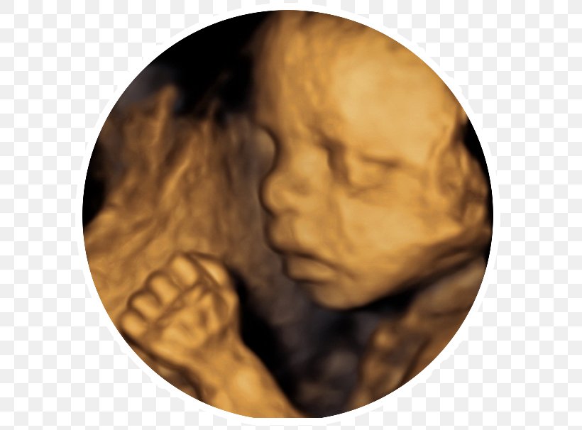 Cabinet Medical Obstetrica-ginecologie Dr.serbanoiu Voluson 730 3D Ultrasound Ultrasonography 4D-Ultraschall, PNG, 687x606px, 3d Ultrasound, Voluson 730, Caesarean Section, Gynaecology, Head Download Free
