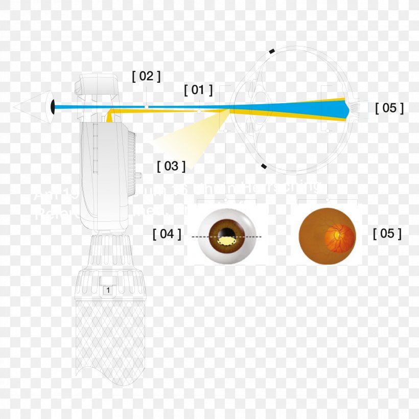 Aspheric Lens Brückner-Test Astigmatism Optische Abbildung Refraktion, PNG, 1920x1920px, Aspheric Lens, Astigmatism, Birth Defect, Brand, Camera Lens Download Free
