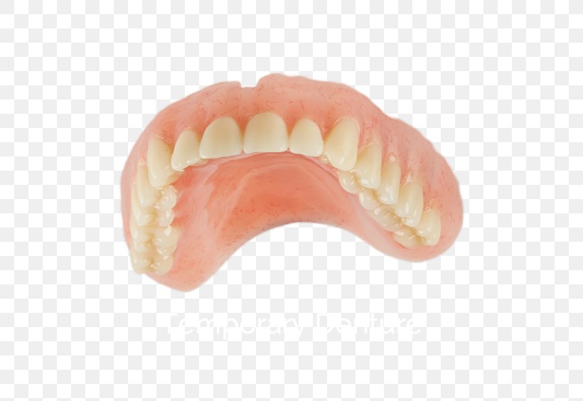 Dentures Human Tooth, PNG, 653x564px, Dentures, Human Tooth, Jaw, Mouth, Peach Download Free