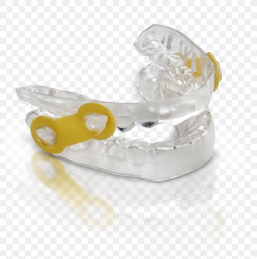 Mandibular Advancement Splint Dentistry Therapy Patient, PNG, 1500x1515px, Mandibular Advancement Splint, Apnea, Crystal, Dentist, Dentistry Download Free