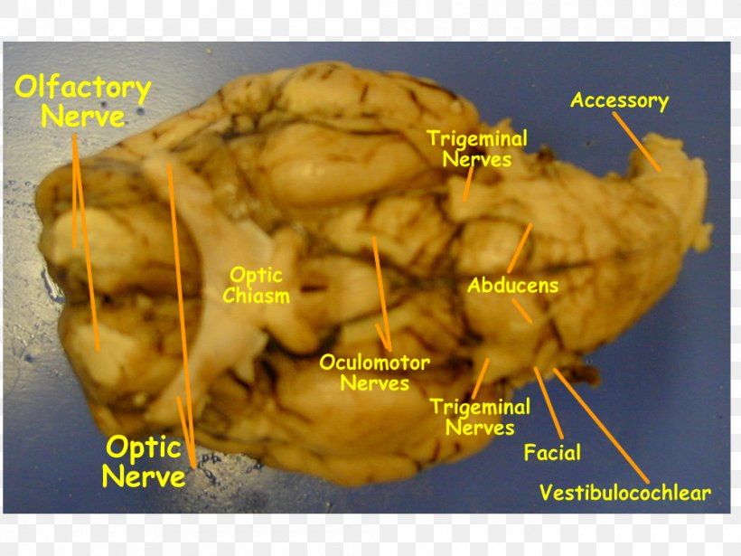 Sheep Cranial Nerves Brain Hypoglossal Nerve Olfactory Nerve, PNG, 1000x750px, Sheep, Abducens Nerve, Anatomy, Brain, Cranial Nerves Download Free