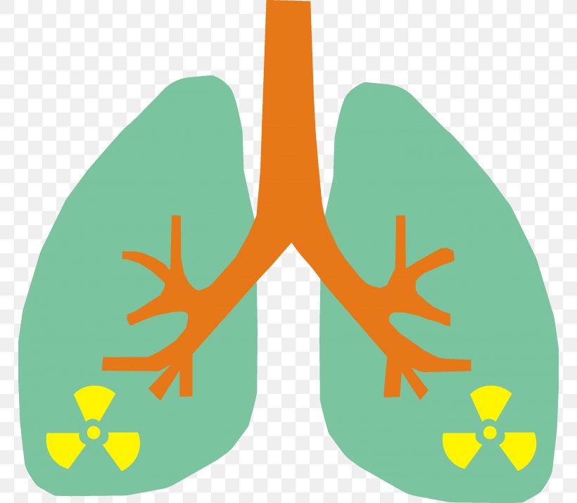 Lung Cancer Radon Smoking, PNG, 768x715px, Lung Cancer, Amphibian, Cancer, Cause, Cough Download Free
