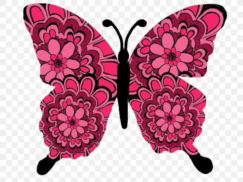 Butterfly Turner Syndrome Cystic Hygroma Down Syndrome, PNG, 1024x768px, Butterfly, Amniocentesis, Arthropod, Chromosome, Down Syndrome Download Free