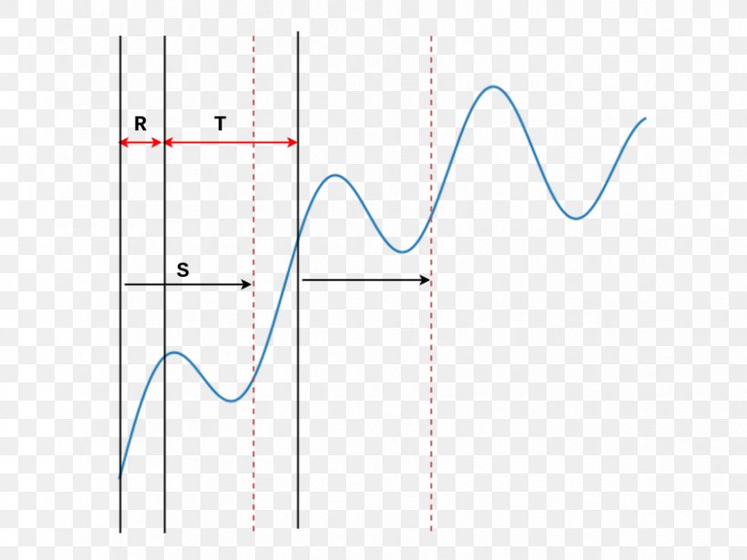 Line Point Angle, PNG, 841x631px, Point, Area, Diagram, Joint, Microsoft Azure Download Free