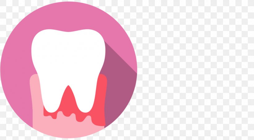 Human Tooth Mouth Gums Dentist, PNG, 1000x552px, Watercolor, Cartoon, Flower, Frame, Heart Download Free