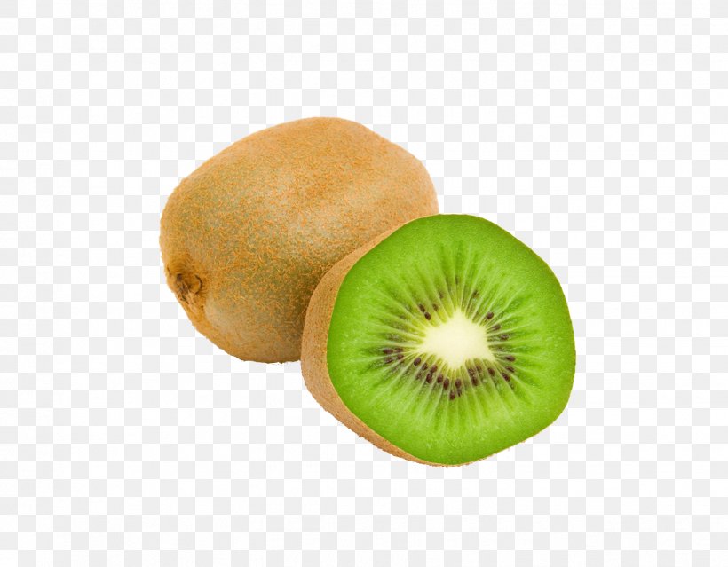 Kiwifruit Food Pineapple Peeler, PNG, 1443x1125px, Kiwifruit, Apple, Auglis, Avocado, Diet Food Download Free