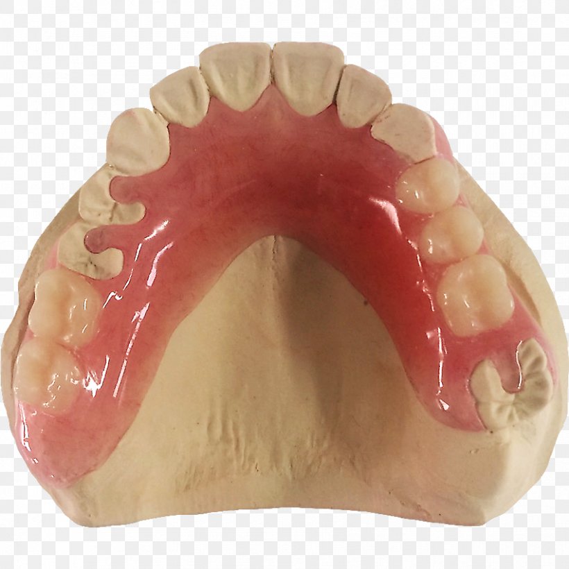 Human Tooth Dentures, PNG, 851x851px, Tooth, Dentures, Human Tooth, Jaw, Lip Download Free