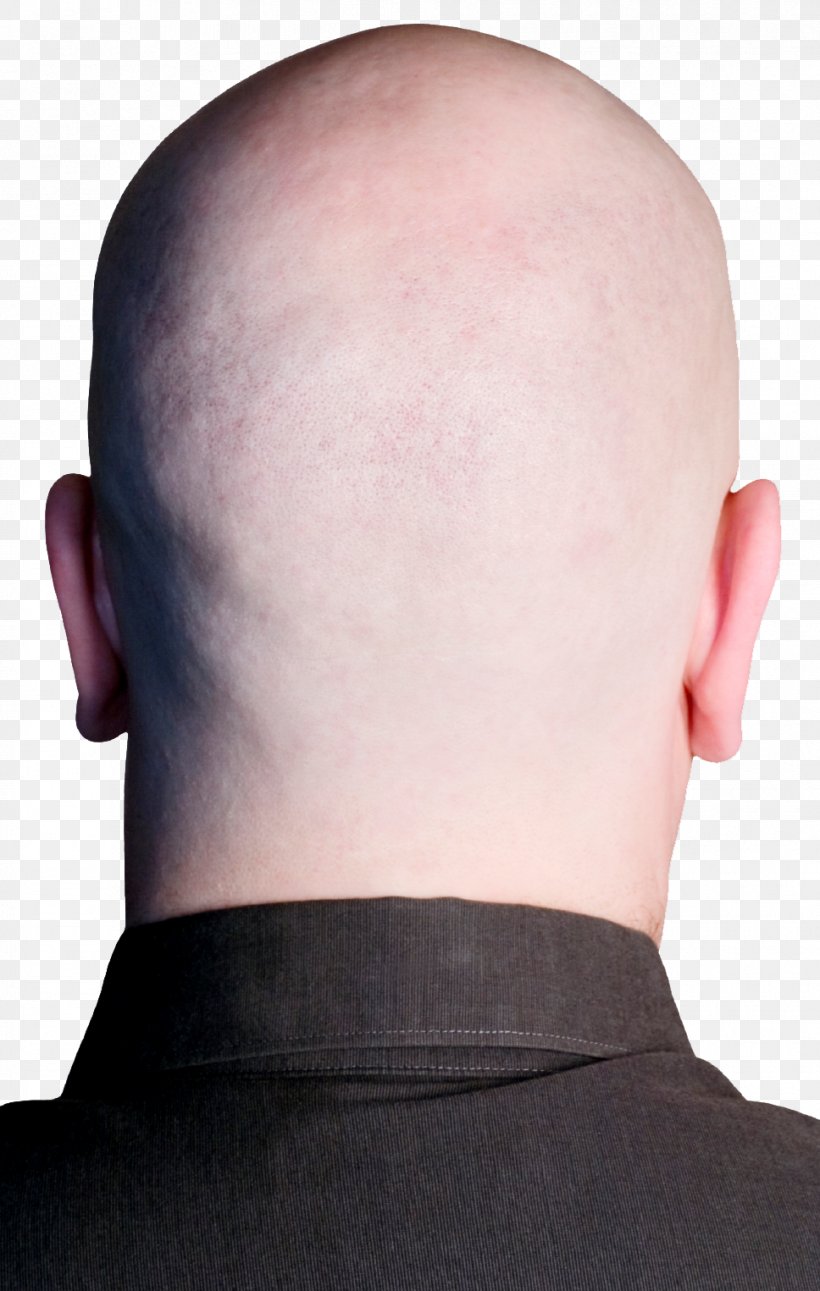 Forehead Chin Neck Hair Loss, PNG, 968x1525px, Head, Brain, Cheek, Chin, Ear Download Free