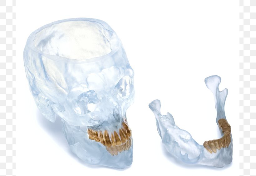 Water Jaw, PNG, 779x563px, Water, Bone, Jaw Download Free