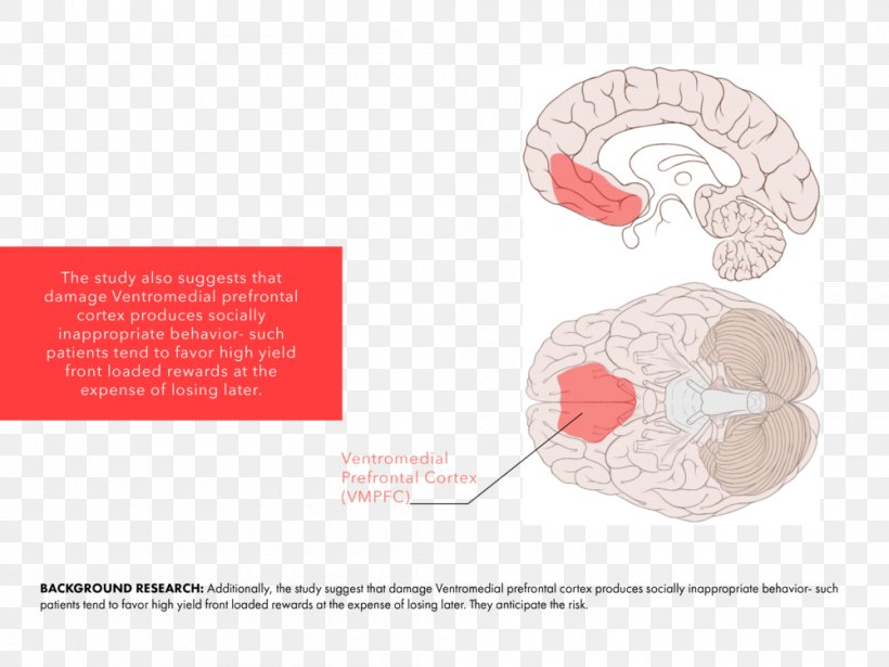 Ventromedial Prefrontal Cortex Diagram Somatic Marker Hypothesis Chart, PNG, 1000x750px, Watercolor, Cartoon, Flower, Frame, Heart Download Free