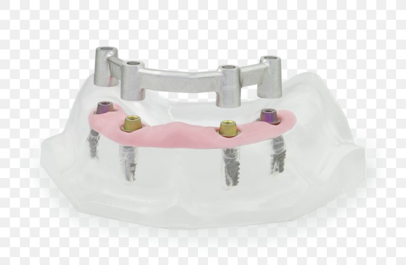 CAD/CAM Dentistry Computer-aided Design Computer-aided Manufacturing, PNG, 800x536px, Dentistry, Cadcam Dentistry, Computeraided Design, Computeraided Manufacturing, Dentist Download Free