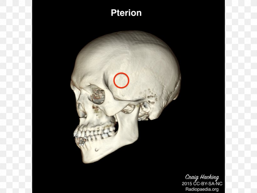 Anatomy Physical Therapy Skull Health, PNG, 1024x768px, Anatomy, Bone, Bulletin Board, Fler, Head Download Free