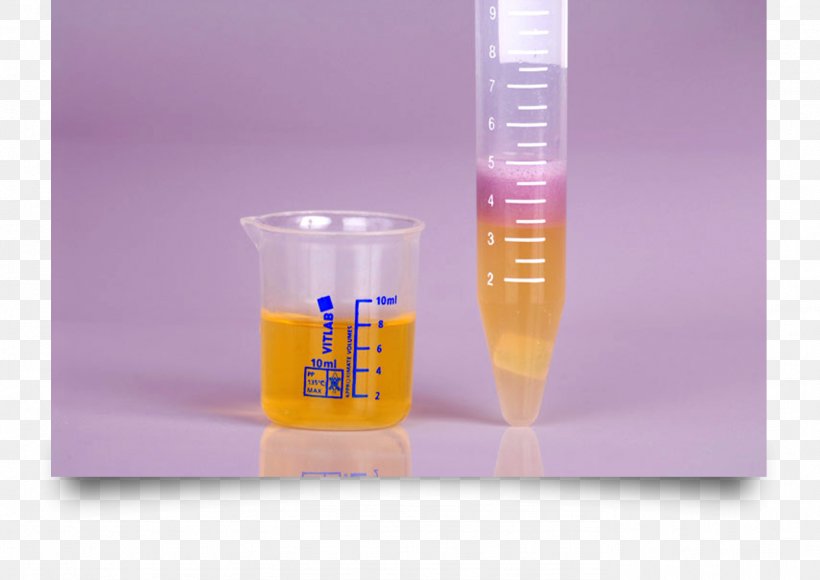 Clinical Urine Tests Drug Test Kidney Blood Test, PNG, 1382x978px, Urine, Blood, Blood Test, Chemical Substance, Clinical Urine Tests Download Free