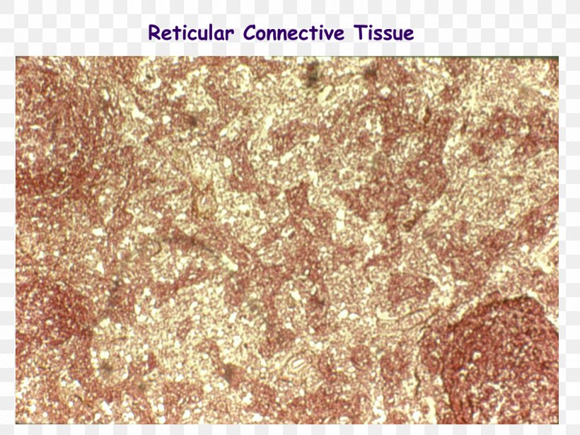 Reticular Connective Tissue Reticular Fiber Dense Irregular Connective Tissue, PNG, 1200x900px, Reticular Connective Tissue, Connective Tissue, Dense Irregular Connective Tissue, Dense Regular Connective Tissue, Dermis Download Free