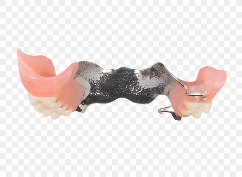 Removable Partial Denture Dentures Dentistry Aspen Dental Lazada Indonesia, PNG, 749x600px, Removable Partial Denture, Aspen Dental, Bukalapak, Combination, Combo Download Free
