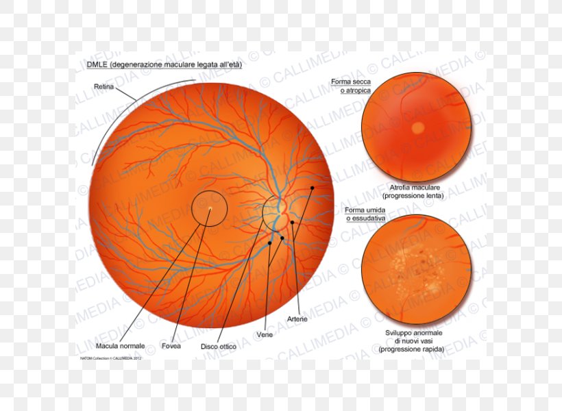 Macular Degeneration Macula Of Retina Old Age Atrophy, PNG, 600x600px, Macular Degeneration, Age, Atrophy, Degeneration, Diagram Download Free