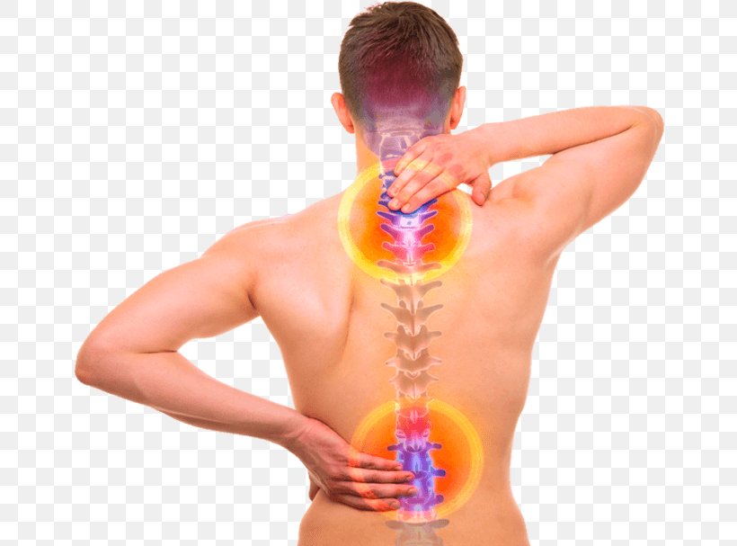 Back Pain Vertebral Column Human Back Human Body Bone, PNG, 660x607px, Watercolor, Cartoon, Flower, Frame, Heart Download Free