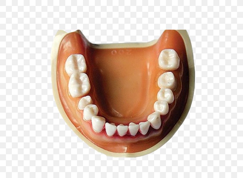 Tooth Dentures Mouth Prototype Crown, PNG, 600x600px, Tooth, Crown, Dentures, Habit, Health Beauty Download Free