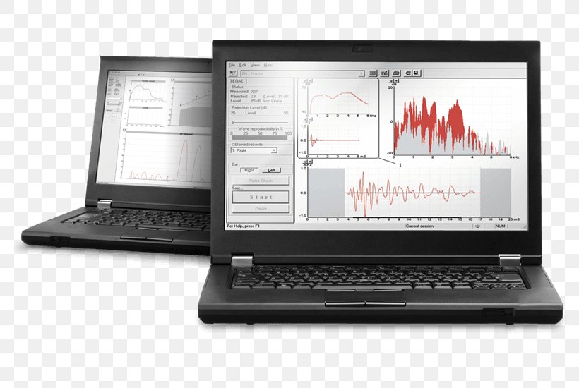 Otoacoustic Emission System Information Computer Software Digital Data, PNG, 798x550px, Otoacoustic Emission, Audiometry, Auditory Brainstem Response, Brand, Computer Hardware Download Free